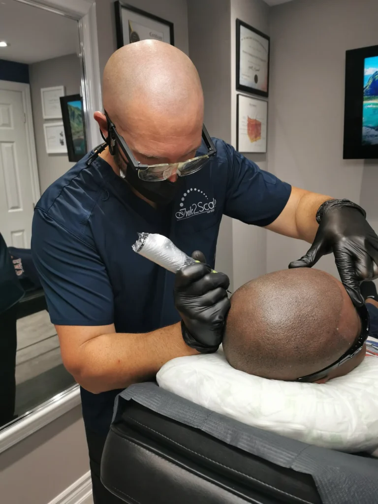 What Tools Do They Use for Scalp Micropigmentation